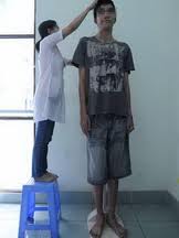 Removing turmor to treat gigantism in 2.03 meter tall Vietnamese man