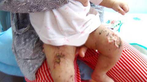 Delta man faces trial for abusing infant stepchild