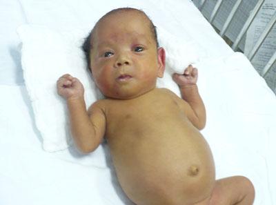 Smallest newborn baby in Vietnam